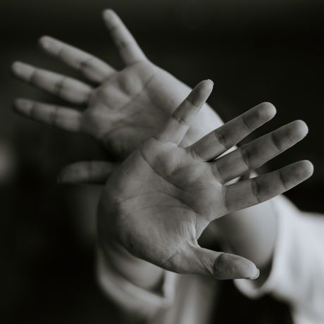 5 tips om je gezicht minder aan te raken